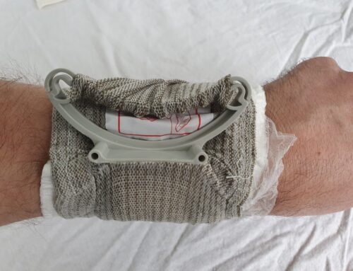 Review – T3 Bandage/Dressing